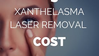 Xanthelasma laser removal cost is it worth it [upl. by Ahiel]