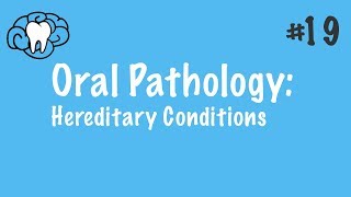 Oral Pathology  Hereditary Conditions  INBDE ADAT [upl. by Inoek]