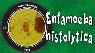 Entamoeba histolyticadispar [upl. by Chicky644]