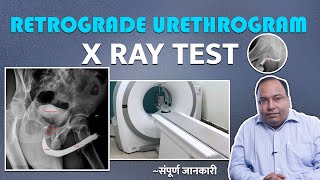 What is Retrograde Urethrogram Test   क्यों किया जाता है और क्या है इसकी प्रक्रिया [upl. by Idram]