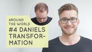 Non Surgical Hair Replacement for Men  Daniels Casual Hairstyle  Around the World Vlog 4 [upl. by Standford]