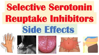 SSRI Antidepressant Side Effects amp Why They Occur  Fluoxetine Paroxetine Sertraline Citalopram [upl. by Nivram]