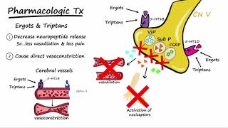 Migraines  Pathophysiology amp Treatment Described Concisely [upl. by Oys]