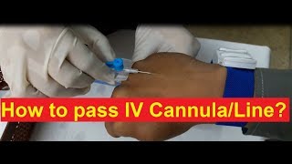 How to Pass IV Cannula [upl. by Colby]