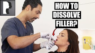 How to dissolve filler [upl. by Parrott161]