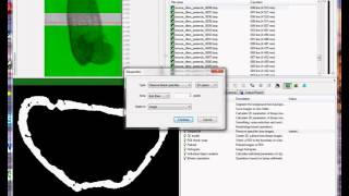 Cortical bone 1 periosteal and endosteal parameters [upl. by Yantruoc]