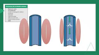 tromboembolismo pulmonar FISIOPATOLOGIA parte 1 [upl. by Ailssa652]