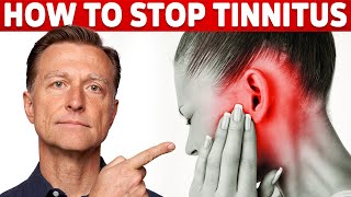 How to Stop Tinnitus ringing in the ears – Try DrBergs Home Remedy to Get Rid of It [upl. by Havard]