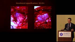 quotUnderlying Mechanisms in Chiari Malformation amp Syringomyeliaquot  Brian J Dlouhy MD [upl. by Siraj]