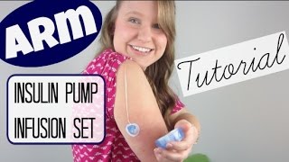 ARM Insulin Pump Infusion Set Tutorial [upl. by Eltsyek]