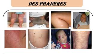 PEDIATRIE Examen clinique du nourrisson [upl. by Yme]