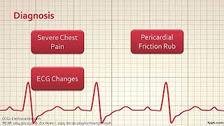 Updates in the Management of Pericarditis [upl. by Hardigg]