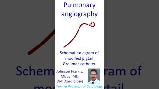 Pulmonary angiography [upl. by Clemence]