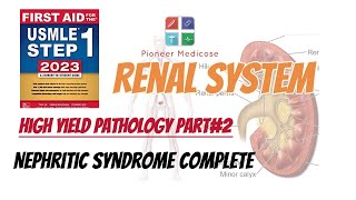 Nephritic Syndrome of Renal System made easy from step 1pathology part 2UrduHindi [upl. by Gollin695]