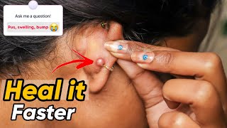 How to Heal Ear Piercing fast QnA Ravina Gupta [upl. by Alvera]