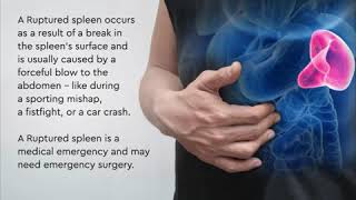 How do you know if your Spleen is rupturedHow long does it take to bleed out from Ruptured Spleen [upl. by Atoked]