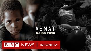 Papua Mengapa masalah gizi buruk masih menghantui Asmat  BBC News Indonesia [upl. by Egide]