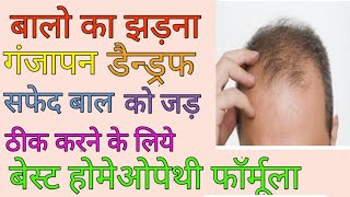 HAIR FALLREASONS AND HOMEOPATHIC TREATMENT AND SOLUTIONS BY DR SACHIN TOMAR [upl. by Assener320]