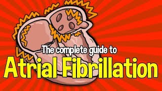 Complete Guide To Atrial Fibrillation Causes symptoms and treatments [upl. by Francyne]