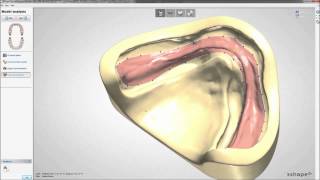 Dental System 2013  Full Dentures [upl. by Ade63]