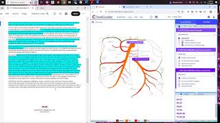 5152024  Mesenteric Arteriogram with Embolization [upl. by Rein548]