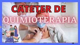 CATÉTER DE QUIMIOTERAPIA [upl. by Natty365]