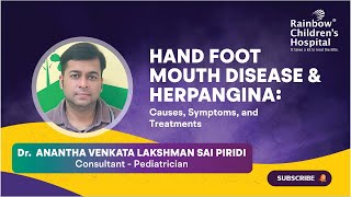 quotHand Foot Mouth Disease amp Herpanginaquot discussed by Dr Anantha Lakshman Consultant Pediatrician [upl. by Artinak]