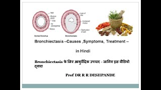 Bronchiectasis l Causes l Symptoms l Treatment l in Hindi l [upl. by Sibella]