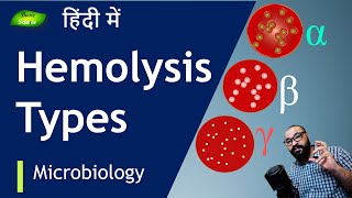 समझें Hemolysis कितनी तरह की होती है   Basic Science Series Hindi [upl. by Sairacaz]