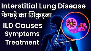 Interstitial Lung Disease फेफड़े का सिकुड़ना ILD Causes Symptoms Treatment [upl. by Maryann949]