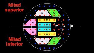 Interpretación del campo visual V Prueba de Hemicampo para Glaucoma PHG [upl. by Nauqan291]