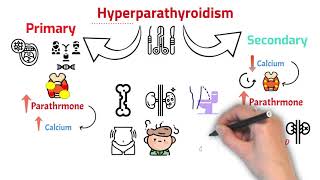 ماذا تعرف عن الغدة الجاردرقية Parathyroid Gland  وعلاقتها بالكالسيوم  وأعراض النقص والزيادة؟ [upl. by Ellehs256]