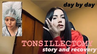 My Tonsillectomy Story and Recovery Day by Day as a 19 Year Old [upl. by Rome]