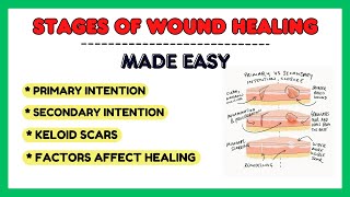 Stages of wound healing keloid scar factors affecting wound healing pathology made easy [upl. by Bouton]