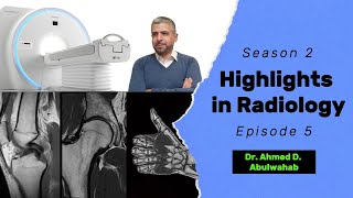 Highlights in Radiology S2 E5 Carpal Tunnel syndrome [upl. by Parhe]