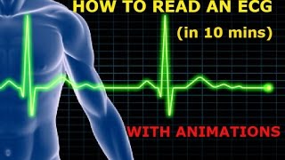 HOW TO READ AN ECG WITH ANIMATIONSin 10 mins [upl. by Anifad139]