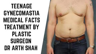 Teenage Gynecomastia Medical facts and Treatment options explained by Plastic Surgeon Dr Arth Shah [upl. by Laehcim]