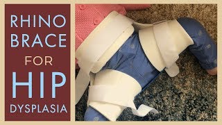 Rhino Brace for Treatment of Hip Dysplasia  Specially Haniya [upl. by Pacorro]