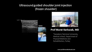 Ultrasound guided shoulder joint injection frozen shoulder [upl. by Lew]