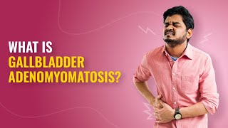 Gallbladder Adenomyomatosis Symptoms Causes and Treatment Explained  MFine [upl. by Lampert]