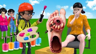 Scary Teacher 3D vs Squid Game Feet Treatment or Error 5 Time Challenge [upl. by Allisirp]