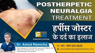 Postherpetic Neuralgia PHN Treatment  हर्पीस जोस्टर के दर्द का इलाज।by Dr Amod Manocha [upl. by Stetson274]