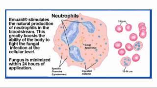 Balanitis Treatment [upl. by Maharg]