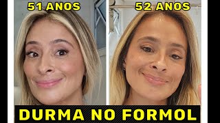 USEI Retinol Vitacid e Vitanol o Ano Inteiro Veja o que Aconteceu [upl. by Dyane]