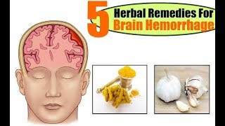 Top 5 Herbal Remedies For Brain Hemorrhage [upl. by Annig]