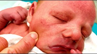 HELP MY NEWBORN HAS A RASH Should I Be Worried  Dr Paul [upl. by Lynnelle]