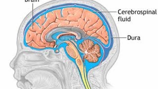 Hydrocephalus  Myelomeningocele  CNS Disorders [upl. by Ahsille]