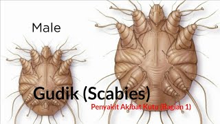 PENYAKIT KULIT  GUDIG Scabies Penyakit yang sering menginfeksi manusia [upl. by Cirone364]