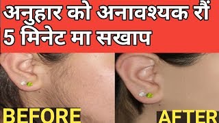 अनुहारको अनावश्यक रौ 5 मिनेटमा हटाउनुश सधैको लागी how to remove facial hair at home in natural [upl. by Matteo]