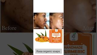 Turmeric soap benefits organicskincaresoaprasaorganicproductsviralvideoshortvideoOrdernow [upl. by Svetlana289]